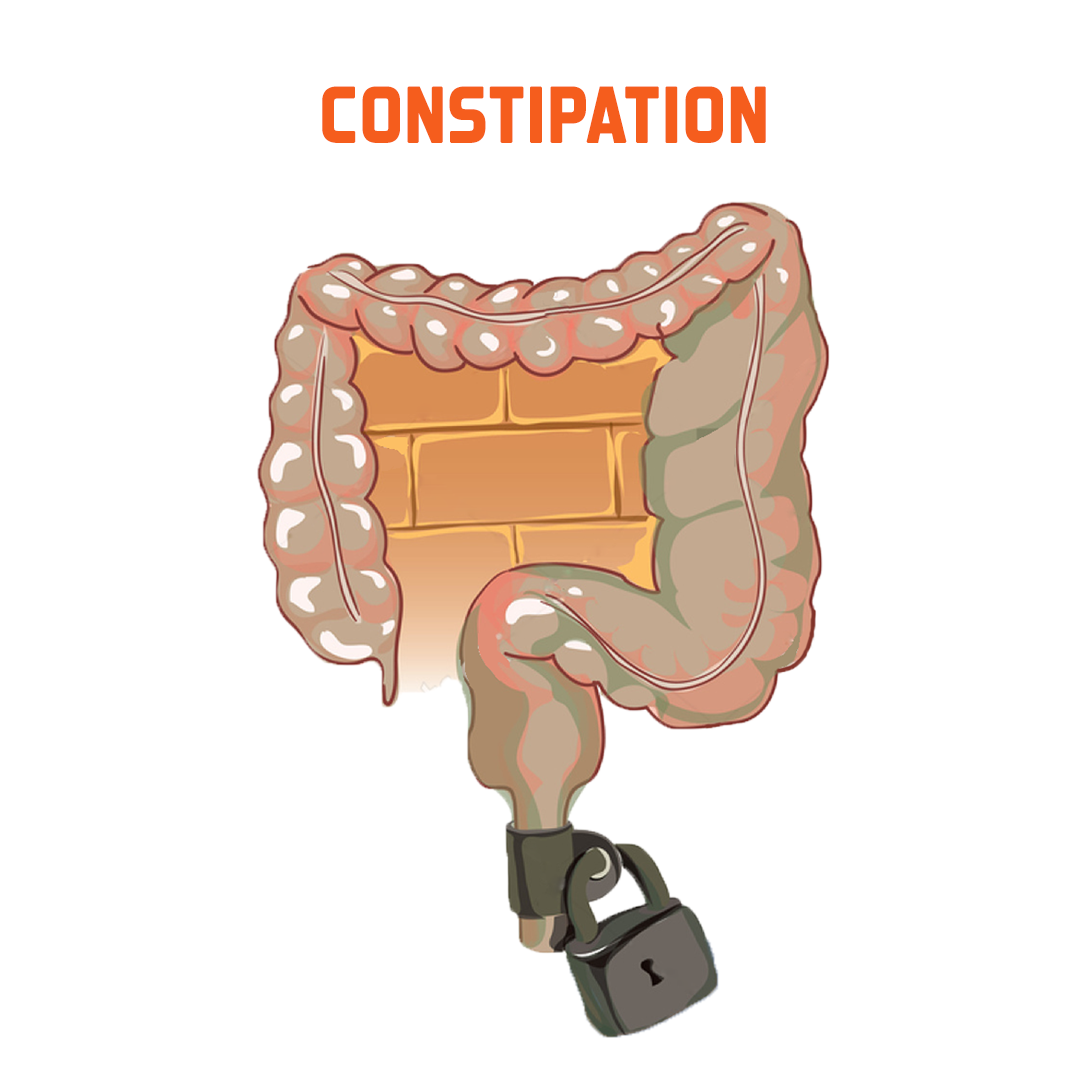 Constipation treatment